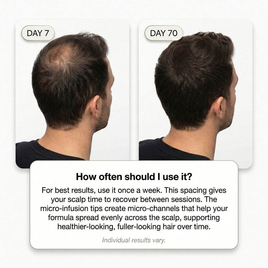 Hair Density System - Keralume™